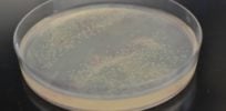 Synthetic Metabolic Pathway c