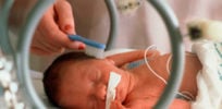 preterm birth