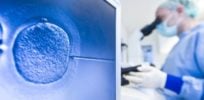 IVF Rex