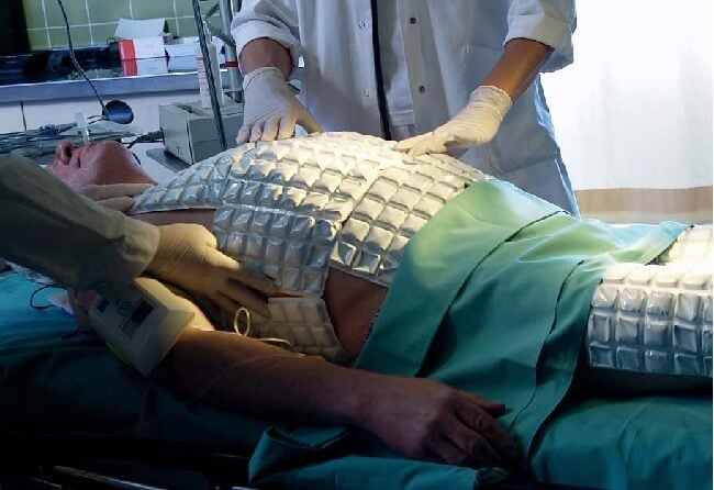 image hires Cold packs on a patient
