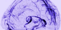 image e Brain Lymphatic System