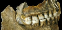 spy ii teeth wide df c bdb b ab f c ca a f