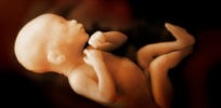 4-15-2019 provocative prenatal folic acid supplements linked to lower risk of autism for kids wrbm large