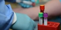 tbi blood test