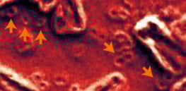 circular cancer dna mischel a
