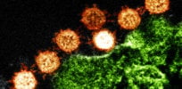 sars coronavirus nih