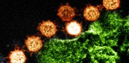 sars coronavirus nih