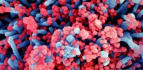 cell infected with coronavirus